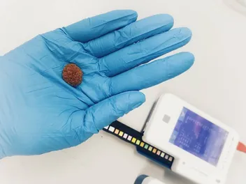 Kidney Stones in Cats (Vet Answer): Causes, Signs & Care