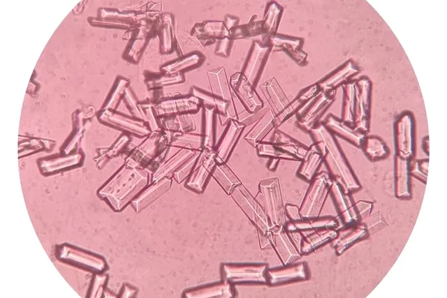What Are Struvite Crystals in Cats? Our Vet Explains Causes & Treatments