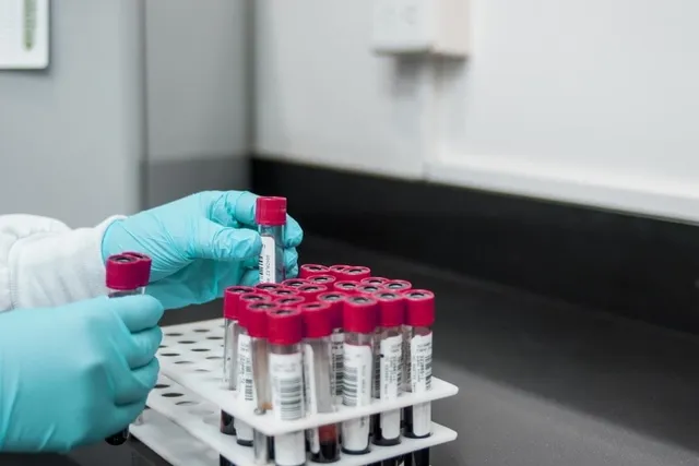 How Much Does a Cat Blood Test Cost? 2026 Pricing Guide