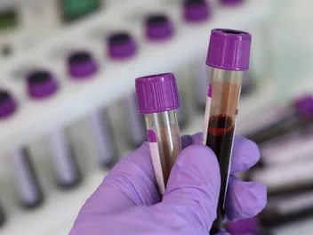 Can a Blood Test Show Cancer in Cats? Vet-Reviewed Facts & FAQ