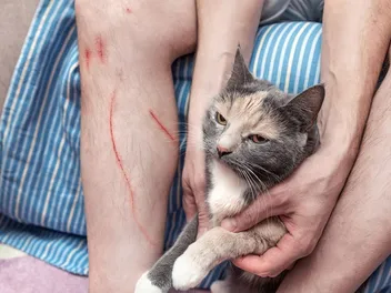 8 Facts About Cat Scratch Fever: Vet Verified