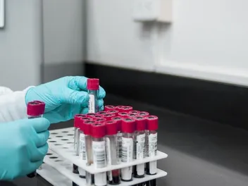 How Much Does a Cat Blood Test Cost? 2026 Pricing Guide