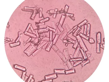 What Are Struvite Crystals in Cats? Our Vet Explains Causes & Treatments