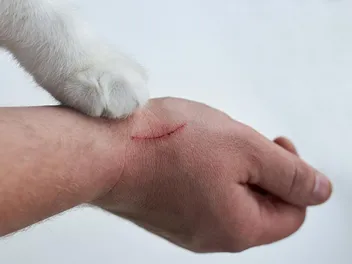 How Common Is Cat Scratch Disease? Facts & Prevention Tips (Vet Answer)