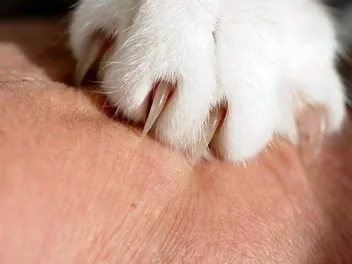 Alternatives to Declawing Your Cat: 8 Humane Options