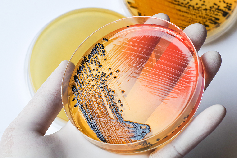 hand holding bacteria growing petri dish