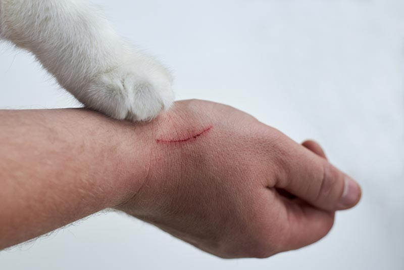 How Common Is Cat Scratch Disease? Facts & Prevention Tips (Vet Answer)