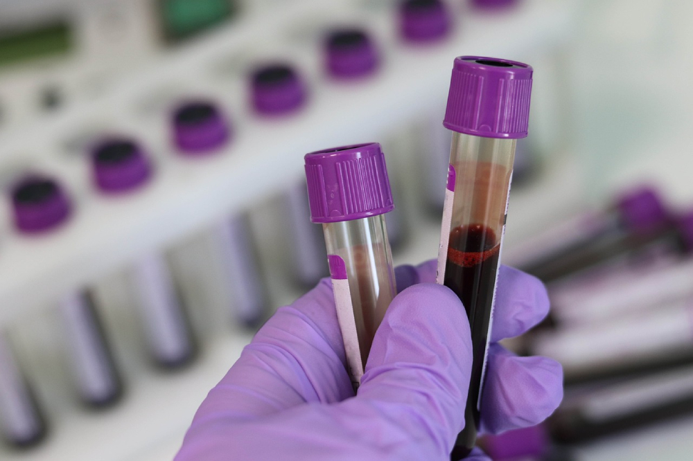 Can a Blood Test Show Cancer in Cats? Vet-Reviewed Facts & FAQ